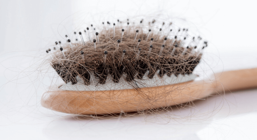 What Causes Hair Loss and How to Treat It