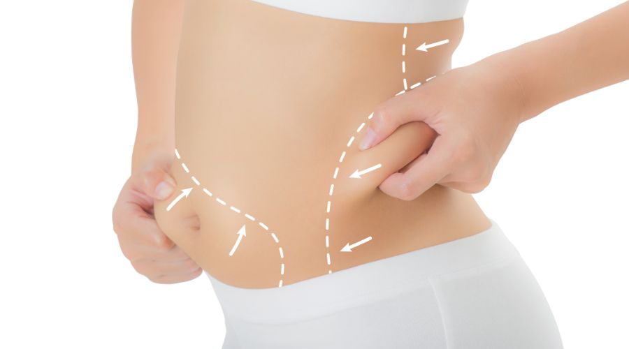 Lower Stomach AirSculpt®  Forget Tummy Tucks and Liposuction