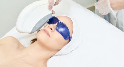 IPL Rosacea and Acne Treatment IPL Rosacea and Acne Treatment