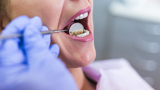 Top Three Signs of Oral Cancer
